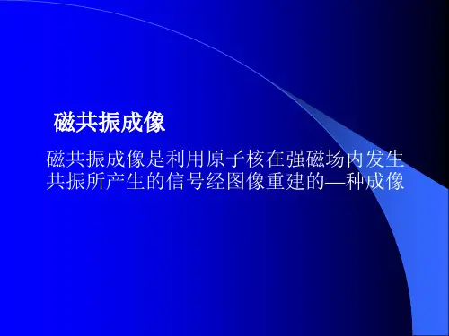 磁共振成像(MRI)