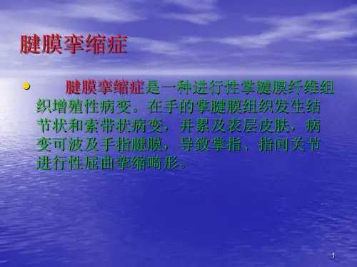 推荐精选掌腱膜挛缩症