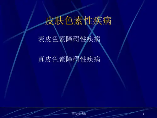 色素性皮肤病【参考仅供】