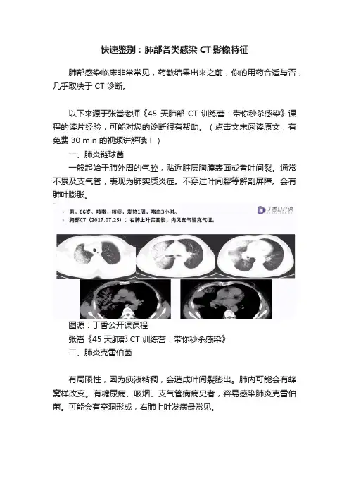 快速鉴别：肺部各类感染CT影像特征