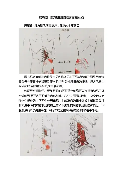 腰臀部-腰方肌肌筋膜疼痛触发点