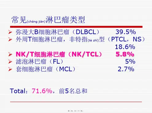 医学专题结外NKT细胞淋巴瘤鼻型15470