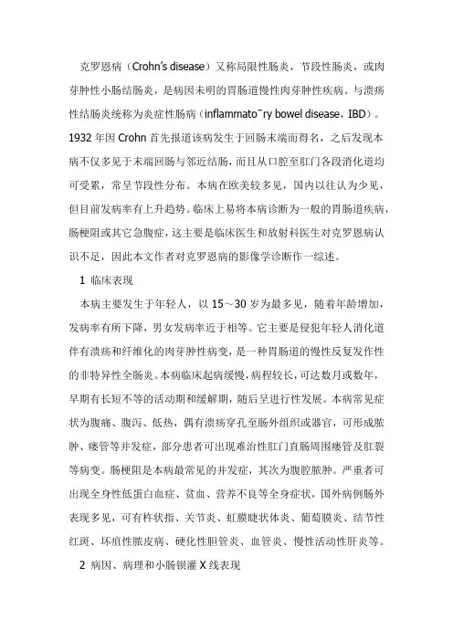 克罗恩病