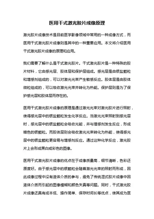 医用干式激光胶片成像原理