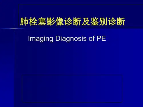 肺栓塞影像诊断及鉴别诊断PPT课件