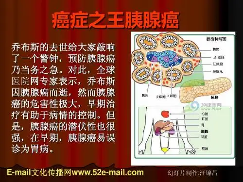 癌症之王胰腺癌