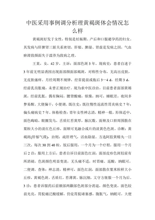 中医采用事例调分析理黄褐斑体会情况怎么样