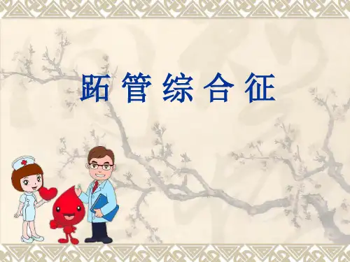 跖管综合症ppt课件