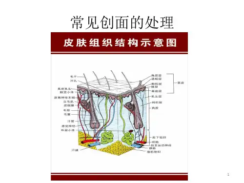 常见创面的处理ppt课件