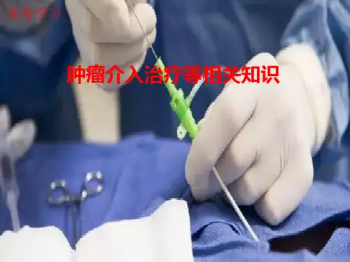 肿瘤介入治疗等相关知识