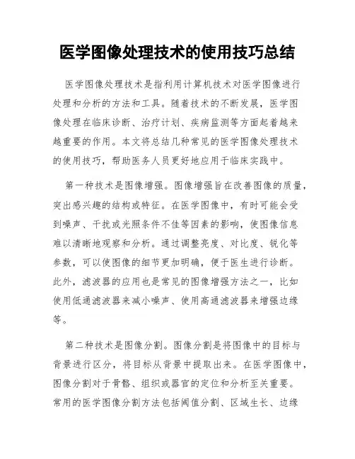 医学图像处理技术的使用技巧总结