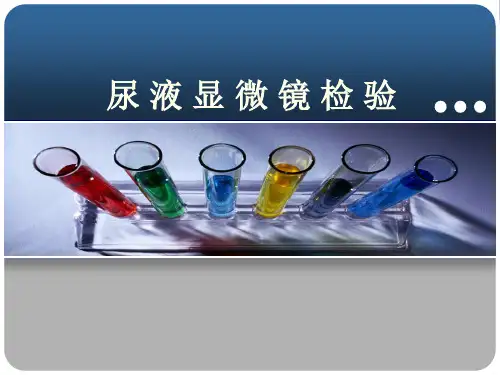 尿液检查显微镜检查PPT课件