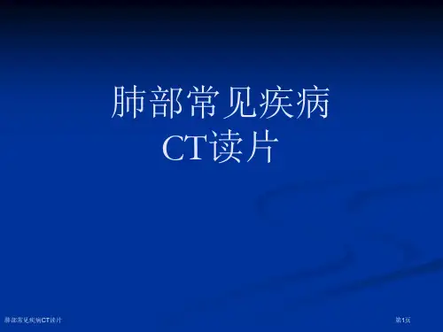 肺部常见疾病CT读片