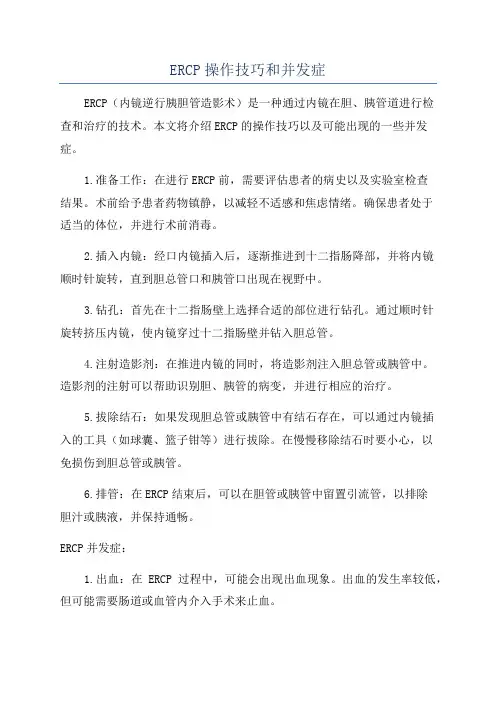 ERCP操作技巧和并发症