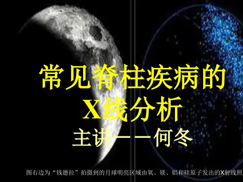 常见脊柱疾病的X线分析演示课件