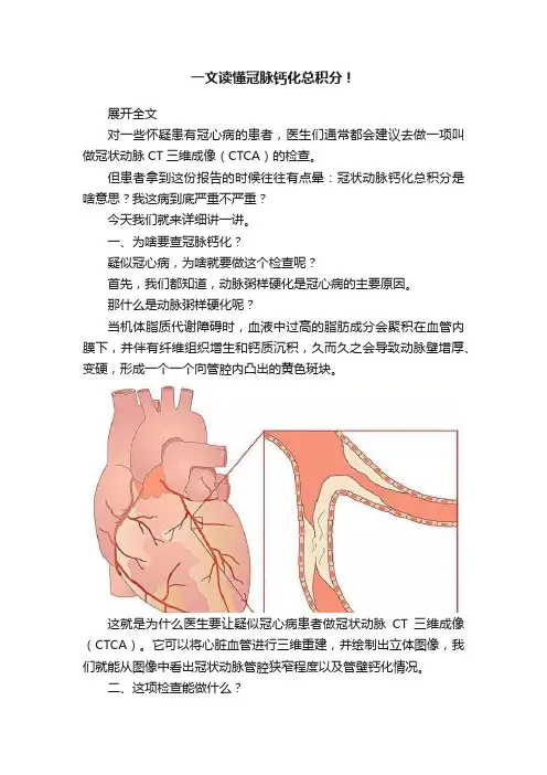 一文读懂冠脉钙化总积分！