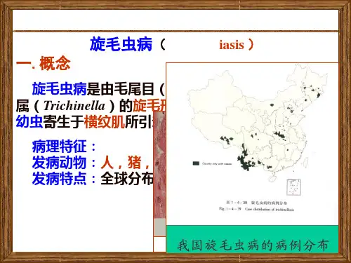 旋毛虫病