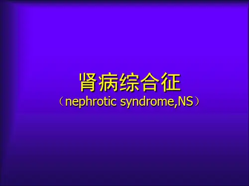 肾病综合征