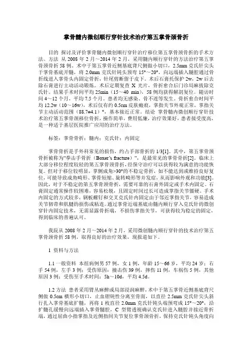 掌骨髓内微创顺行穿针技术治疗第五掌骨颈骨折