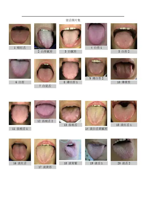 中医舌诊图集