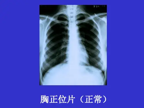 各种常见病x光碟 各种X光片