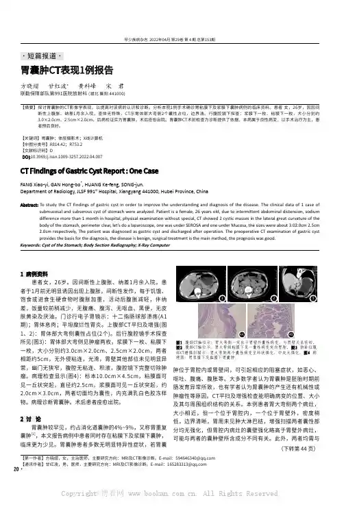 胃囊肿CT表现1例报告