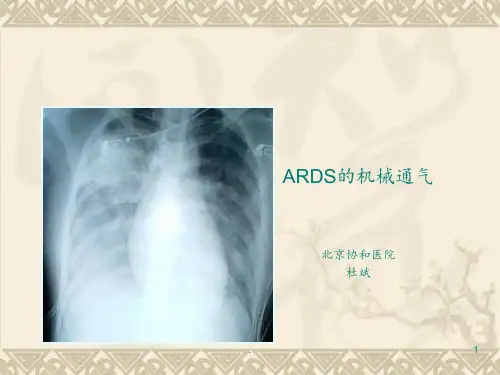 10-MICU-杜斌教授PPT课件