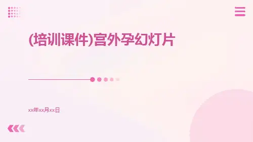 (培训课件)宫外孕幻灯片