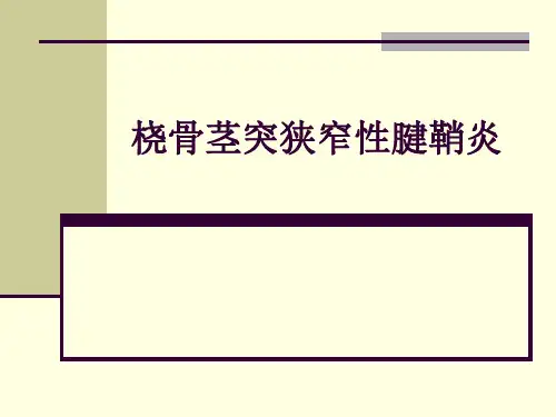 中医骨伤科PPT课件】桡骨茎突狭窄性腱鞘炎课件