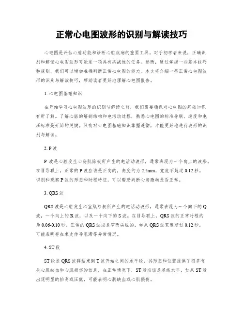 正常心电图波形的识别与解读技巧