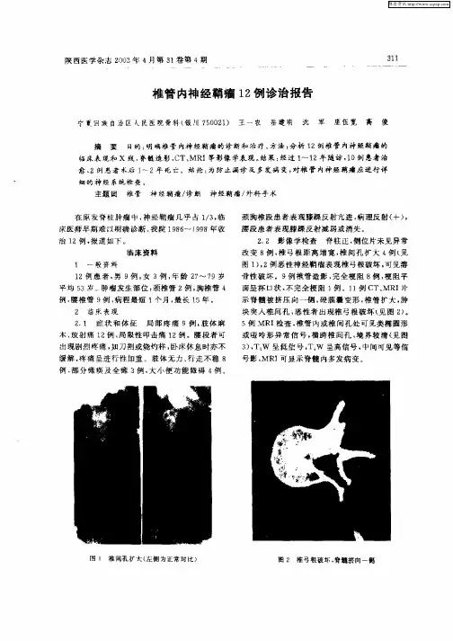 椎管内神经鞘瘤12例诊治报告