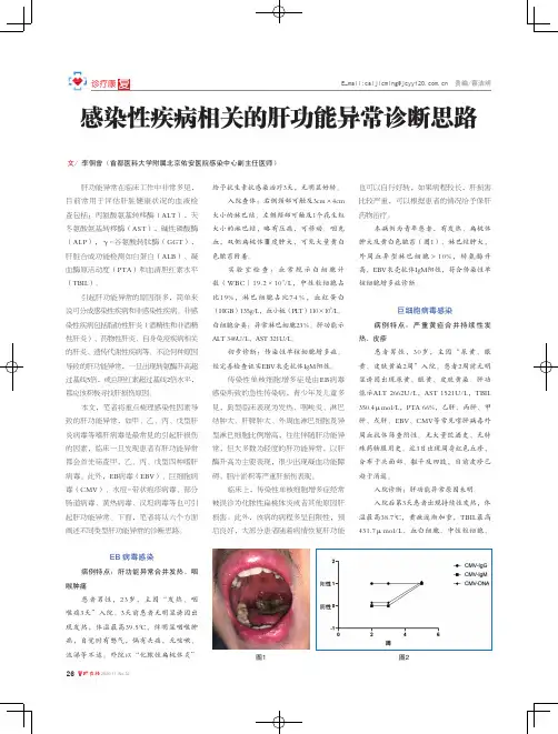 感染性疾病相关的肝功能异常诊断思路