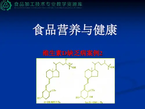 维生素D缺乏病案例2.