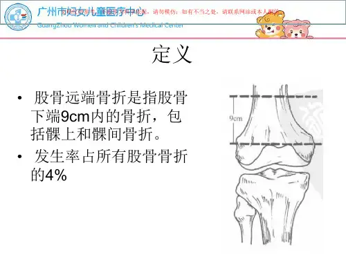 儿童股骨远端骨折培训课件