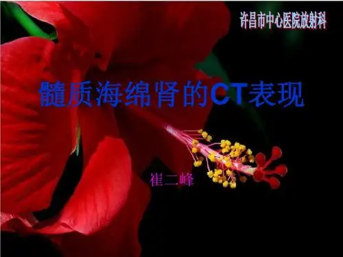 髓质海绵肾