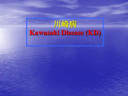 川崎病幻灯片ppt课件