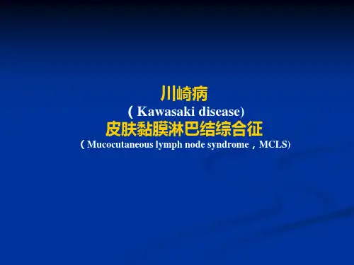 皮肤黏膜淋巴结综合征ppt