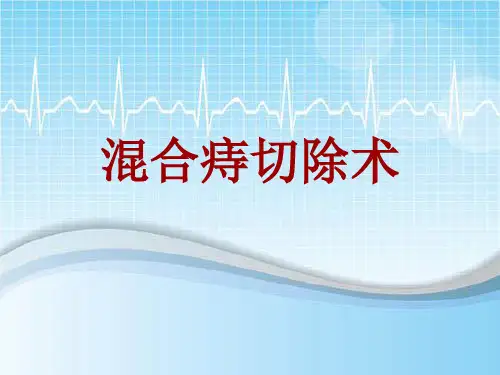 手术讲解模板：混合痔切除术