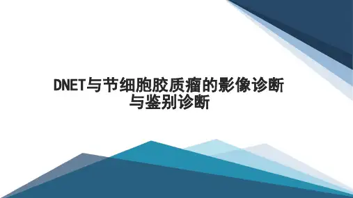 DNET与节细胞胶质瘤的影像诊断与鉴别诊断