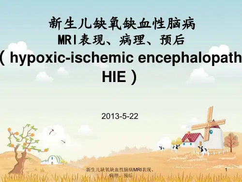 新生儿缺氧缺血性脑病MRI表现、病理、预后课件