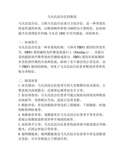 马凡氏综合征的眼部