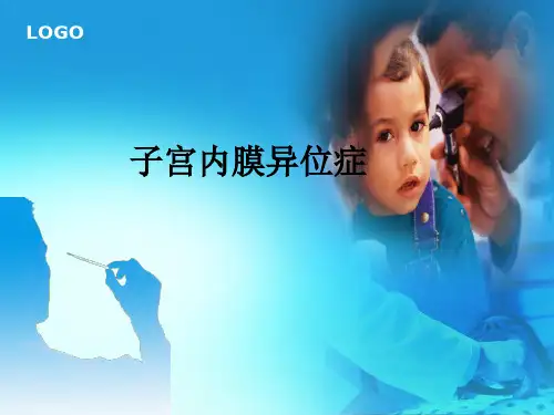 子宫内膜异位症-精品医学 课件