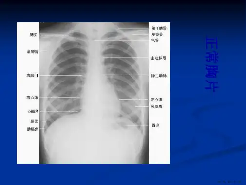 执业医师资格技能考试X线培训(共61页)