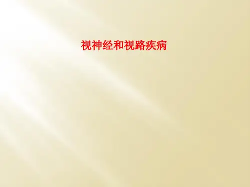 视神经和视路疾病
