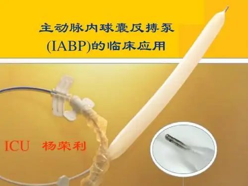 IABP的临床应用
