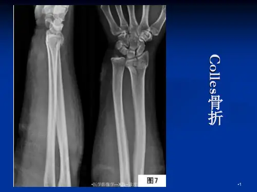 医学影像学---X线--读片考试练习总结课件