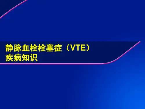静脉血栓栓塞症(VTE)疾病知识