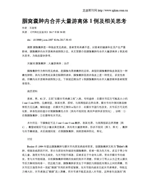 腘窝囊肿内合并大量游离体1例及相关思考