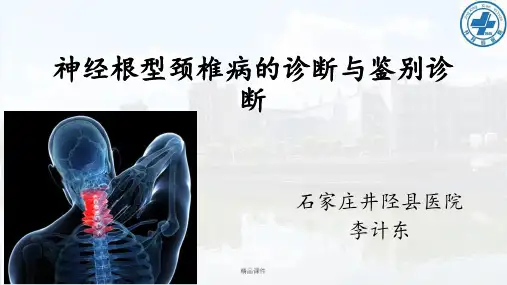 神经根型颈椎病的诊断与鉴别诊断