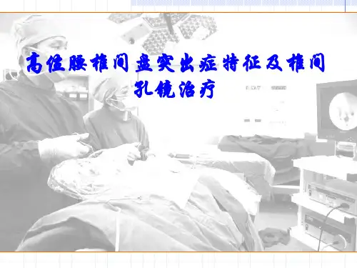 高位腰椎间盘突出症特征及椎间孔镜治疗